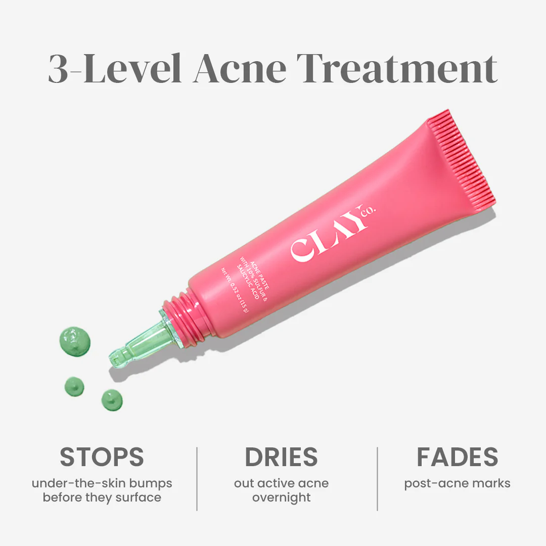Acne Paste with 10% Sulfur & Salicylic Acid | 15g - Image 6